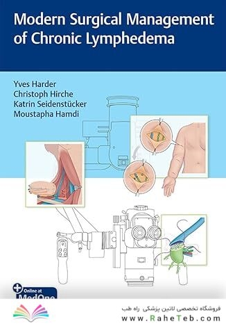 Modern Surgical Management of Chronic Lymphedema 1st Edition
