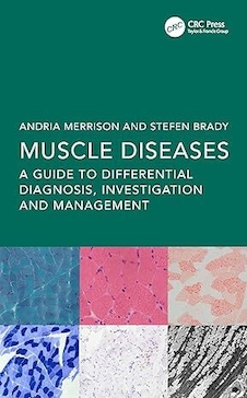 عکس Muscle Diseases: A Guide to Differential Diagnosis, Investigation and Management 1st Edition
