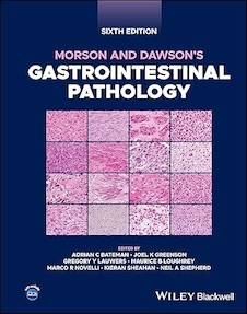 عکس Morson and Dawson