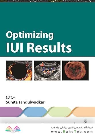 Optimizing IUI Results
