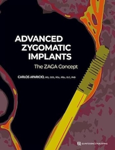 عکس Advanced Zygomatic Implants: The Zaga Concept 1st Edition