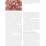 Advanced Zygomatic Implants: The Zaga Concept 1st Edition