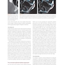 Advanced Zygomatic Implants: The Zaga Concept 1st Edition