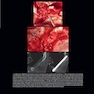 Advanced Zygomatic Implants: The Zaga Concept 1st Edition