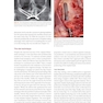 Advanced Zygomatic Implants: The Zaga Concept 1st Edition