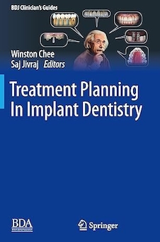 عکس Treatment Planning In Implant Dentistry