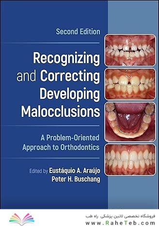 Recognizing and Correcting Developing Malocclusions: A Problem-Oriented Approach to Orthodontics