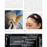 Advances in Hyaluronic Acid Filler Injections
