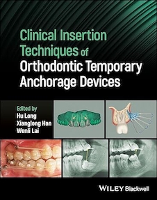 عکس Clinical Insertion Techniques of Orthodontic Temporary Anchorage Devices 1st Edition