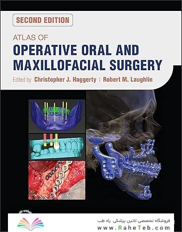 Atlas of Operative Oral and Maxillofacial Surgery 2nd Edition