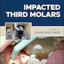 Impacted Third Molars 2nd Edition
