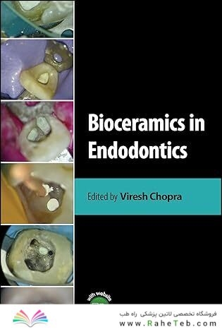Bioceramics in Endodontics 1st Edition
