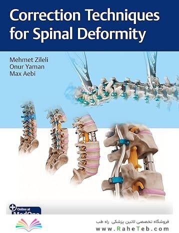 Correction Techniques for Spinal Deformity