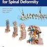 Correction Techniques for Spinal Deformity