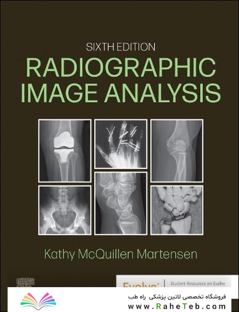 Radiographic Image Analysis 6th Edition