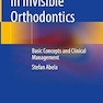 ALIGNER SYSTEMS IN INVISIBLE ORTHODONTICS BASIC CONCEPTS AND CLINICAL MANAGEMENT