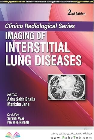 Clinico Radiological Series-Imaging of Interstitial Lung Diseases