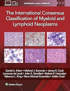 عکس The International Consensus Classification of Myeloid and Lymphoid Neoplasms First Edition