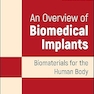 An Overview of Biomedical Implants: Biomaterials for the Human Body 1st Edition