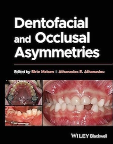 عکس Dentofacial and Occlusal Asymmetries 1st Edition