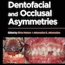 Dentofacial and Occlusal Asymmetries 1st Edition