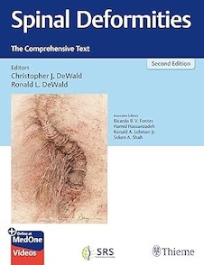 عکس pinal Deformities: The Comprehensive Text 2nd Edition