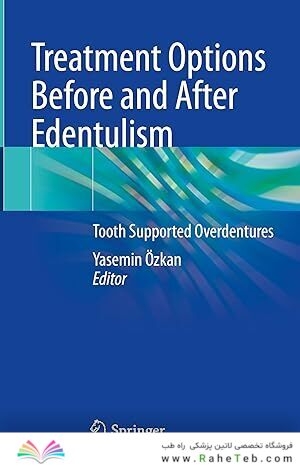 Treatment Options Before and After Edentulism: Tooth Supported Overdentures 1st ed