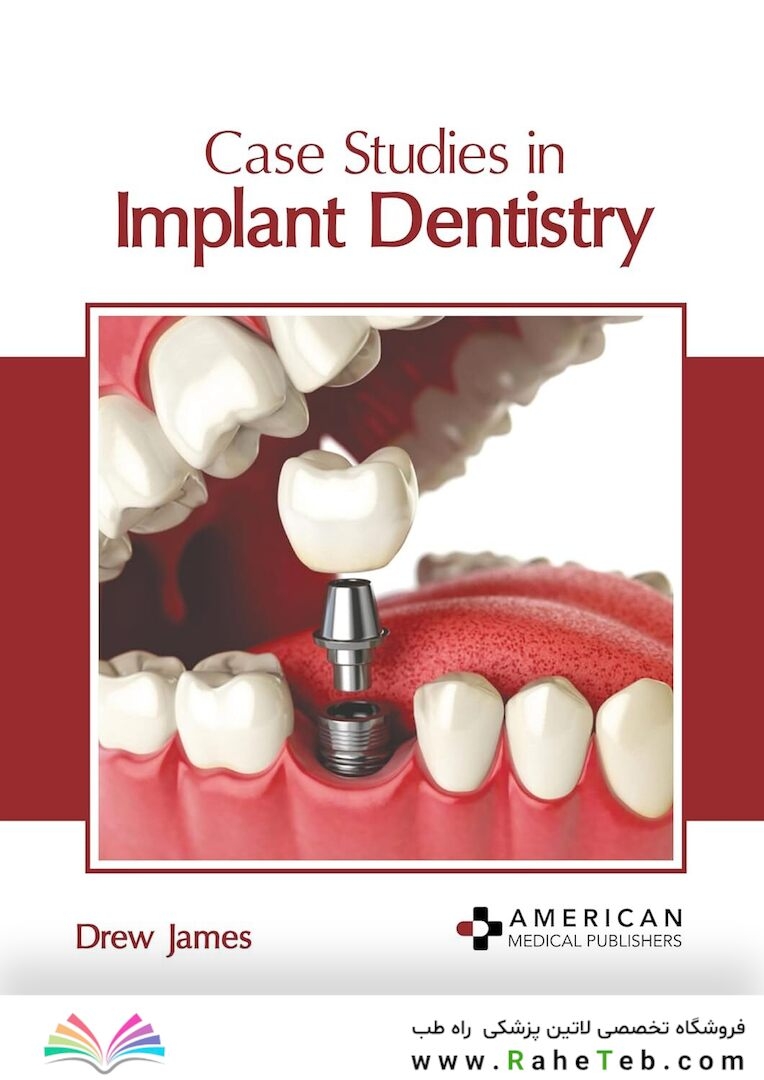 Case Studies in Implant Dentistry