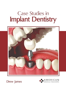عکس Case Studies in Implant Dentistry