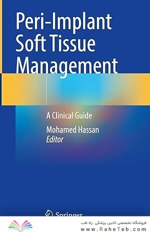 Peri-Implant Soft Tissue Management: A Clinical Guide