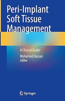 عکس Peri-Implant Soft Tissue Management: A Clinical Guide