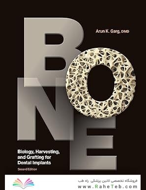 Bone: Biology, Harvesting, and Grafting for Dental Implants, 2nd Edition