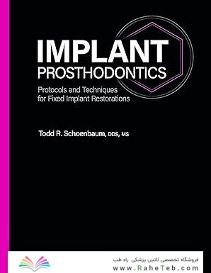 Implant Prosthodontics: Protocols and Techniques for Fixed Implant Restorations