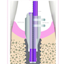 Implant Prosthodontics: Protocols and Techniques for Fixed Implant Restorations