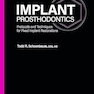 Implant Prosthodontics: Protocols and Techniques for Fixed Implant Restorations
