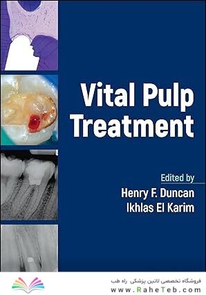 Vital Pulp Treatment