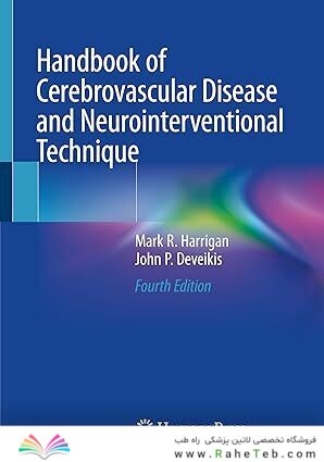 Handbook of Cerebrovascular Disease and Neurointerventional Technique