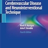 Handbook of Cerebrovascular Disease and Neurointerventional Technique