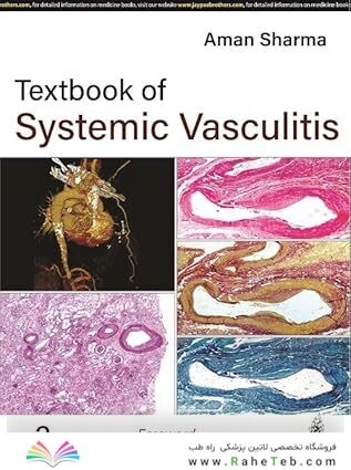 Textbook of Systemic Vasculitis 2nd Edition