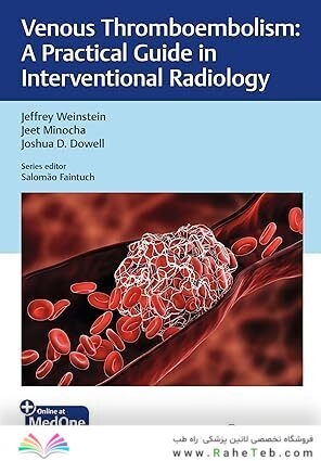 Venous Thromboembolism: A Practical Guide in Interventional Radiology