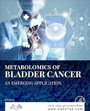 Metabolomics of Bladder Cancer: An Emerging Application 1st Edition