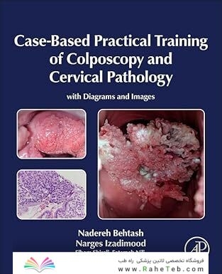 Case-Based Practical Training of Colposcopy and Cervical Pathology: With Diagrams and Images