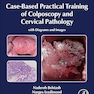 Case-Based Practical Training of Colposcopy and Cervical Pathology: With Diagrams and Images