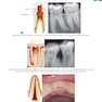 Textbook of Endodontics 5th Edition