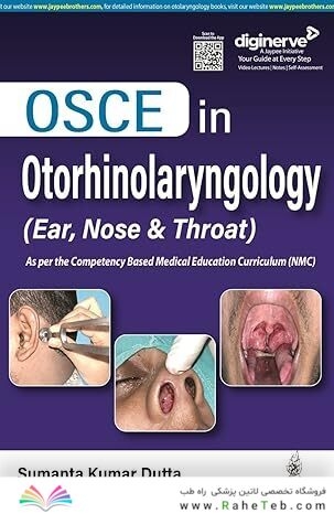 OSCE in Otorhinolaryngology