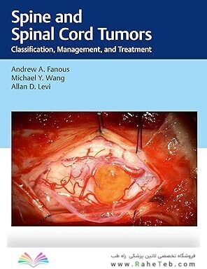 Spine and Spinal Cord Tumors: Classification, Management, and Treatment 1st Edition