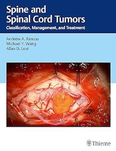 عکس Spine and Spinal Cord Tumors: Classification, Management, and Treatment 1st Edition