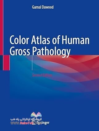 Color Atlas of Human Gross and Microscopic Pathology Second Edition