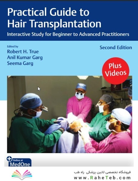 Practical Guide to Hair Transplantation Interactive Study for Beginner to Advanced