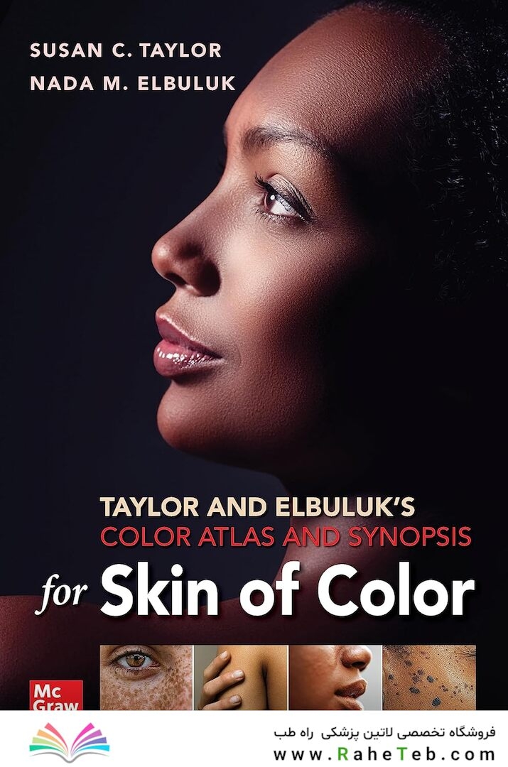 Taylor and Elbuluk